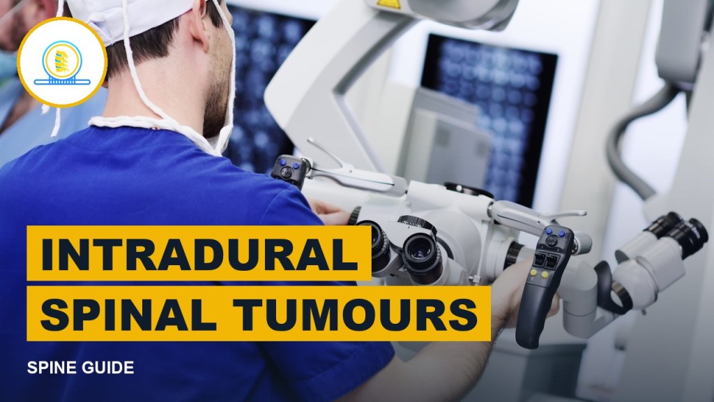 Intradural spinal tumours guide