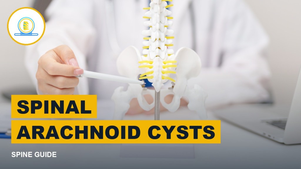 Spinal arachnoid cysts guide