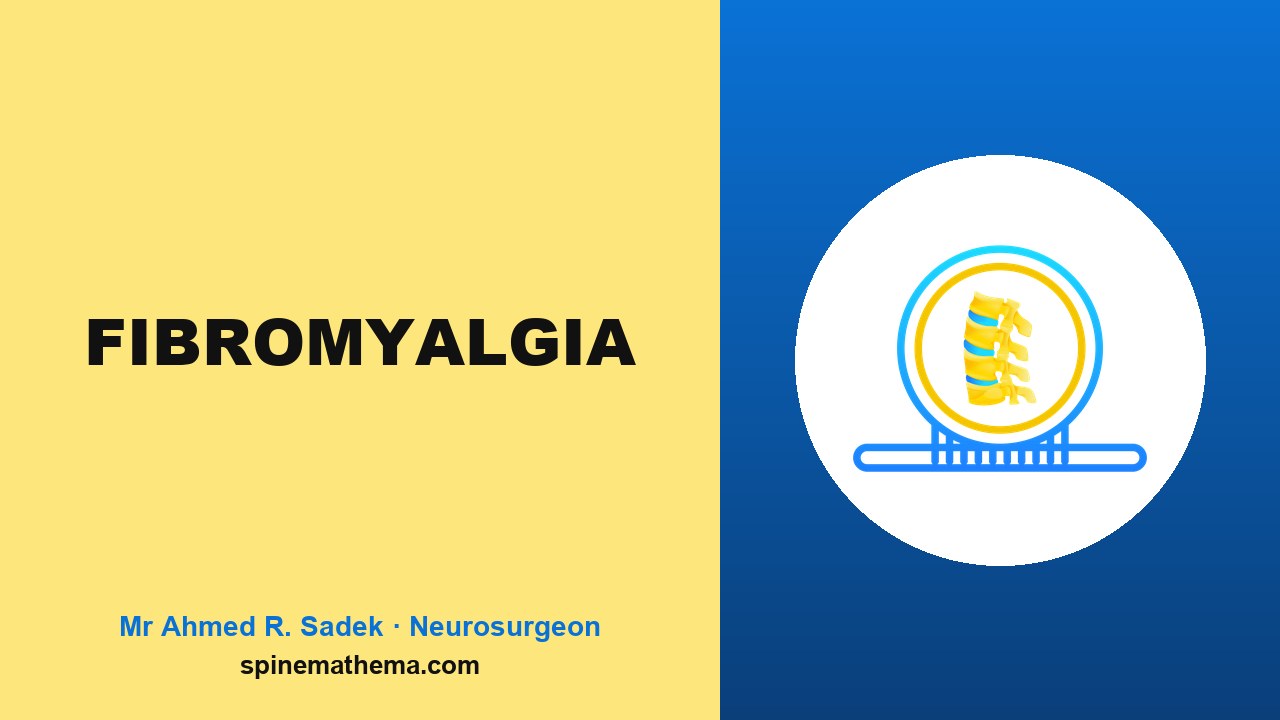 Fibromyalgia video thumbnail