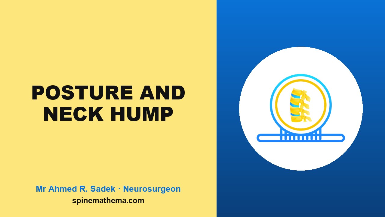 Posture and neck hump video thumbnail