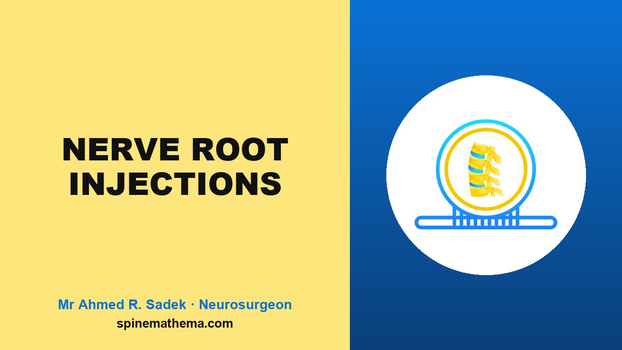 Nerve root injections picture