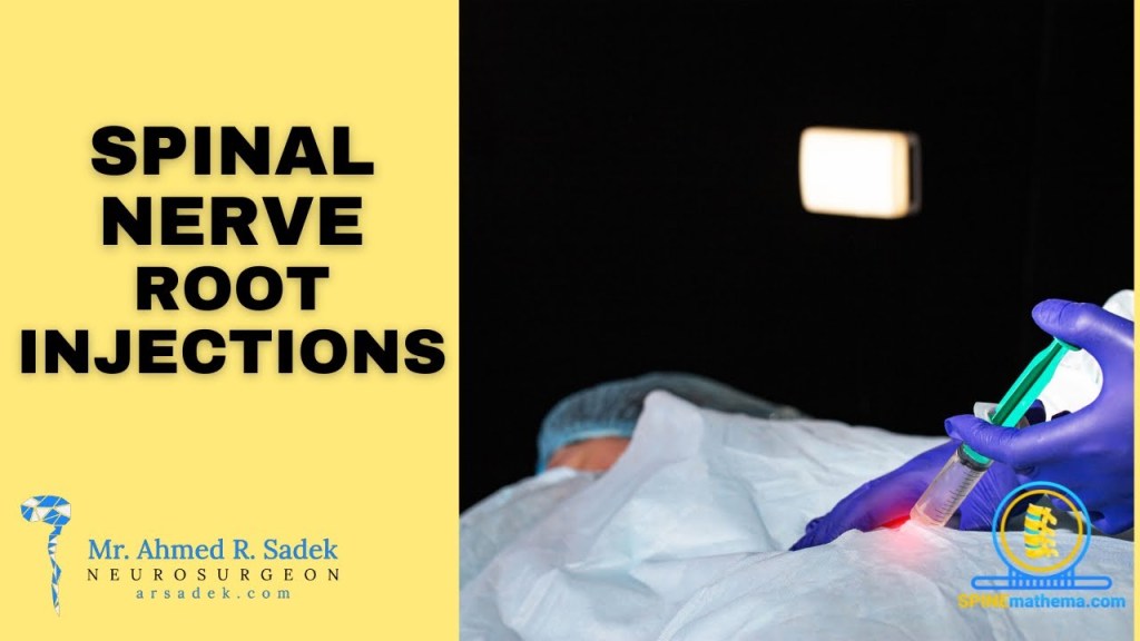 Spinal nerve root injections video thumbnail