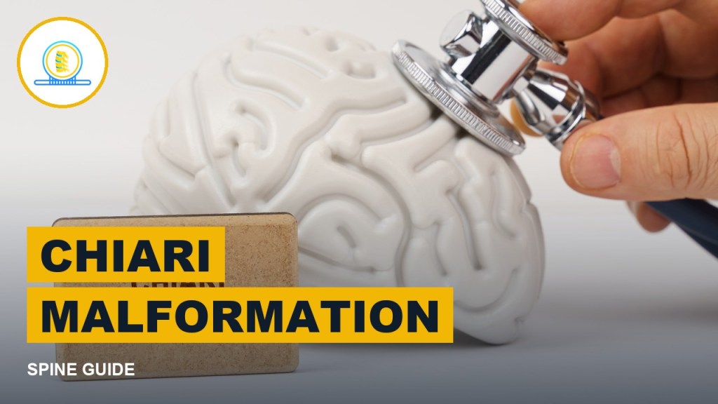 Chiari Malformation: Symptoms, Scans and Treatment