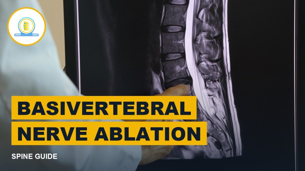 Basivertebral nerve ablation picture