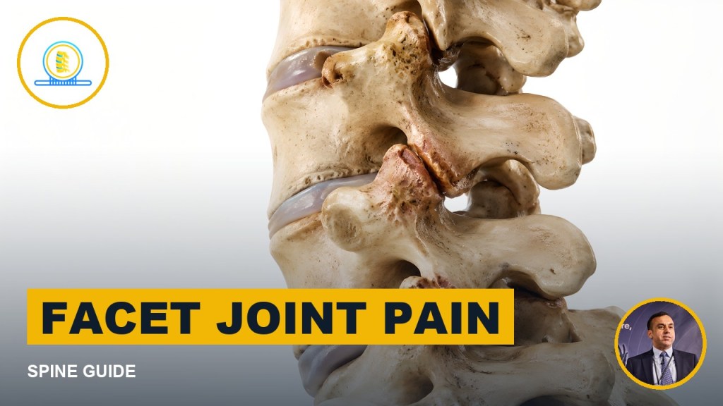 Facet joint pain picture