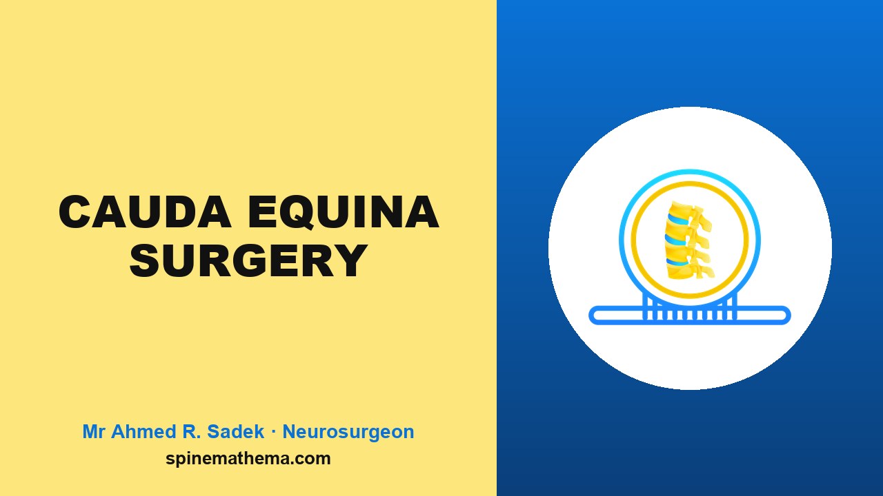 Emergency surgery for cauda equina syndrome picture