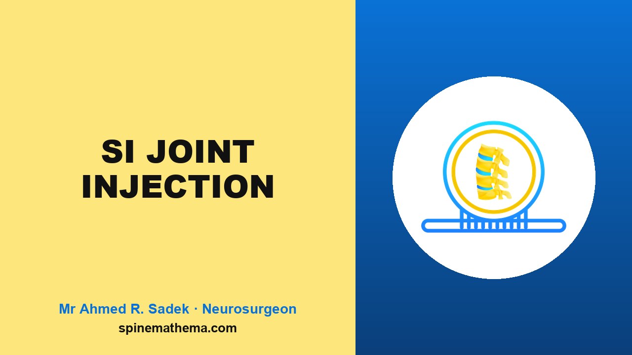 Sacroiliac joint injections picture