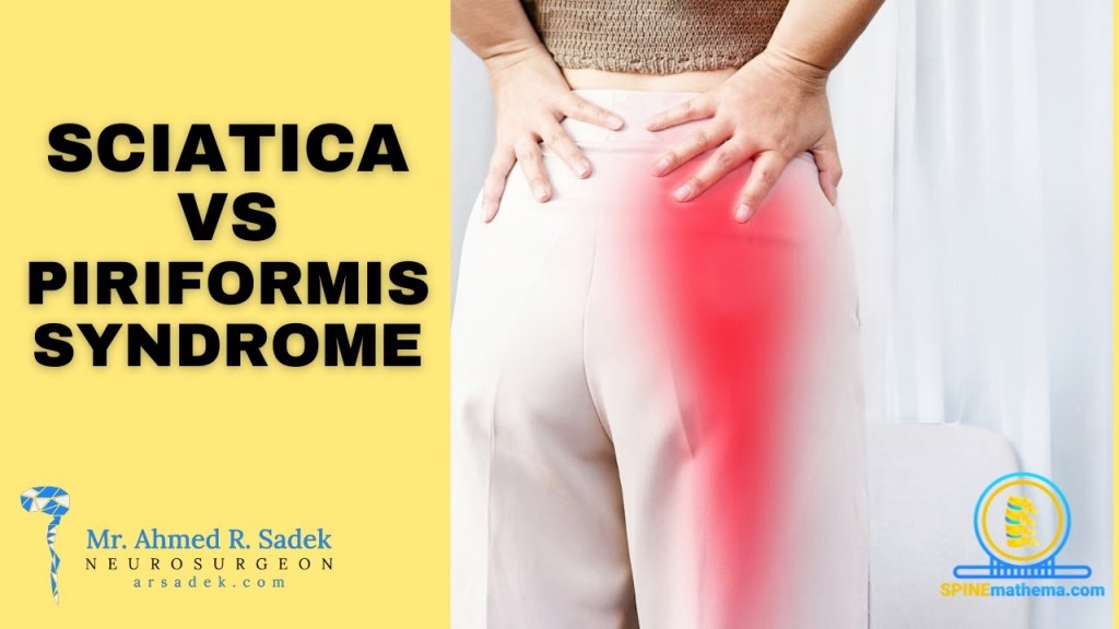 Sciatica vs Piriformis Syndrome video thumbnail