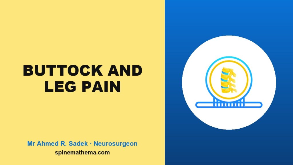 Buttock and leg pain