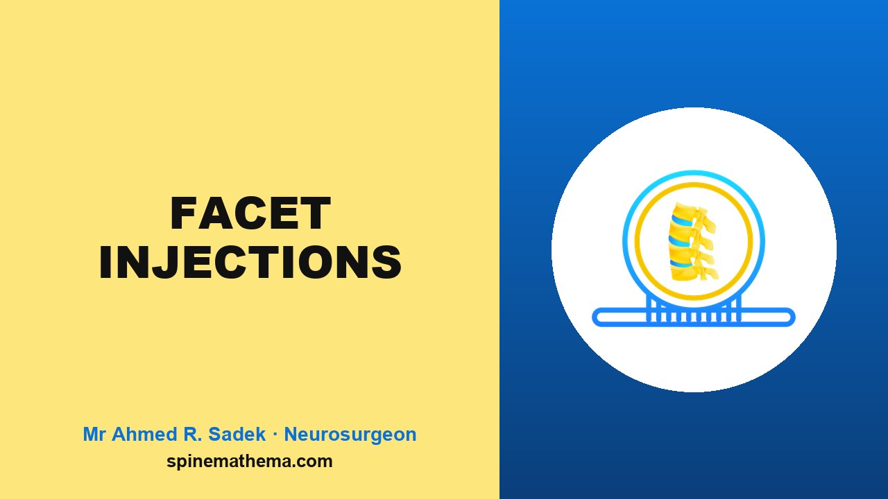 Facet joint injections picture