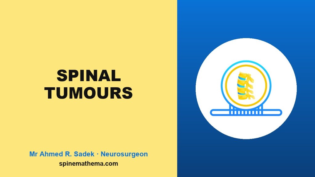 Spinemathema picture card for Spinal Tumours